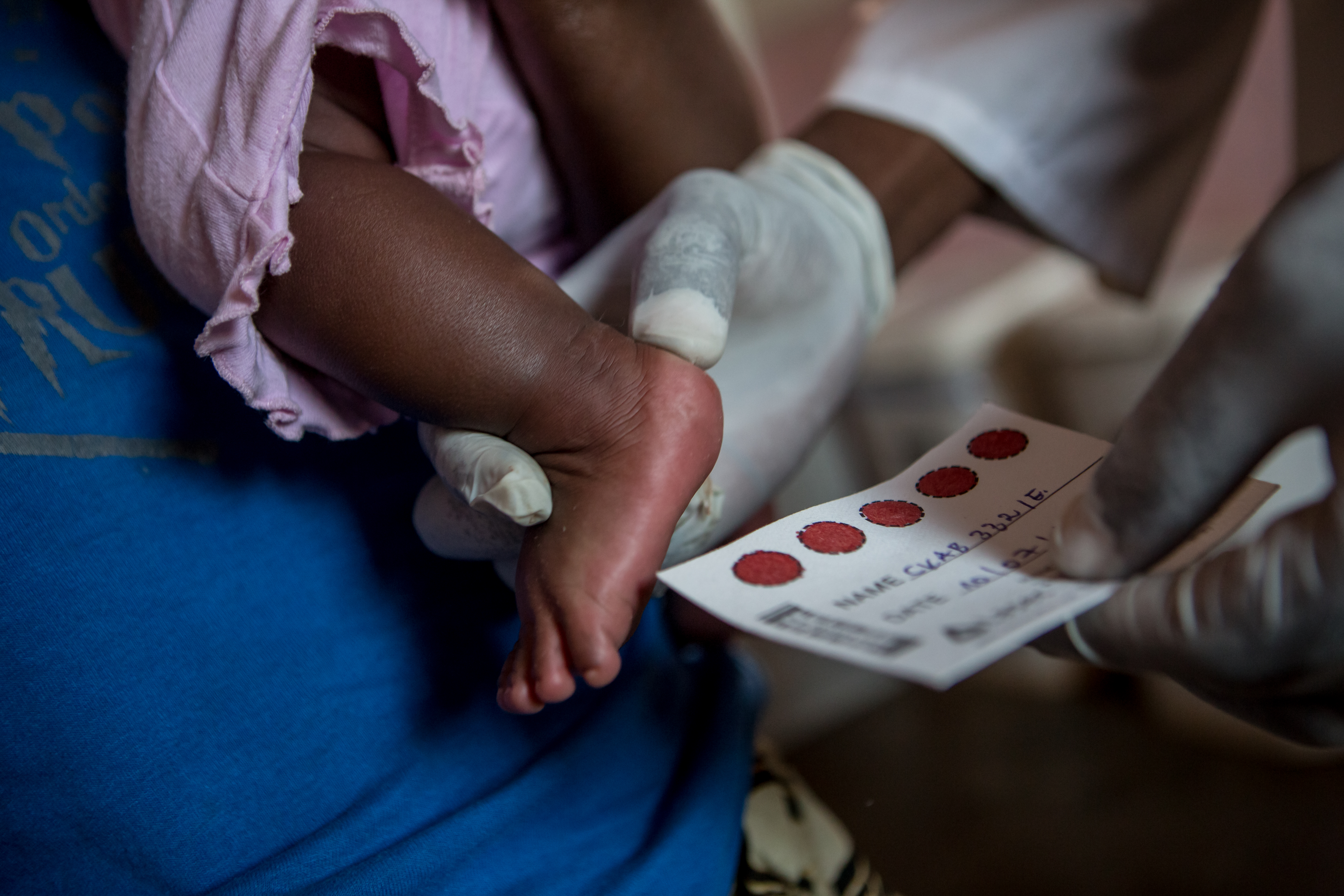 一名婴儿正在以足部采血的方式通过PCR测试检测HIV病毒，这些检测结果会发送到最近的实验室。