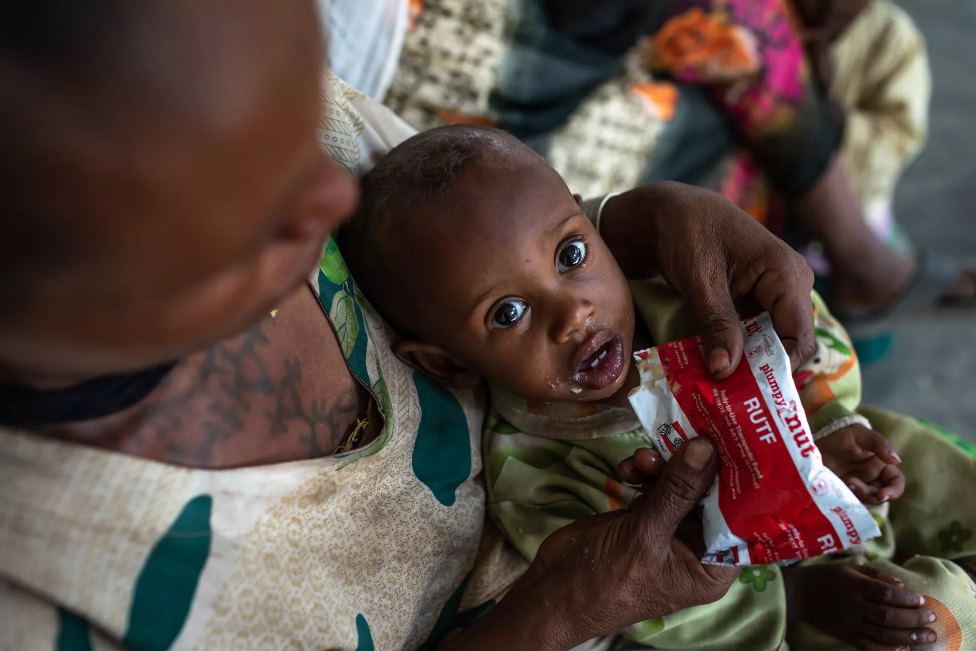 Letmedhin Eyasu holds her son Zewila Gebru, 1 year old, who is suffering from malnutrition at Agbe Health Center in the Tigray region of northern Ethiopia, on Monday, June 7, 2021. Zewila was provided with 2 weeks supply of RUTF.
