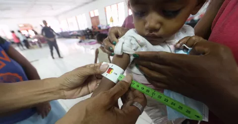 2021年4月东帝汶发生洪灾后，首都帝力的儿童在接受营养不良筛查。