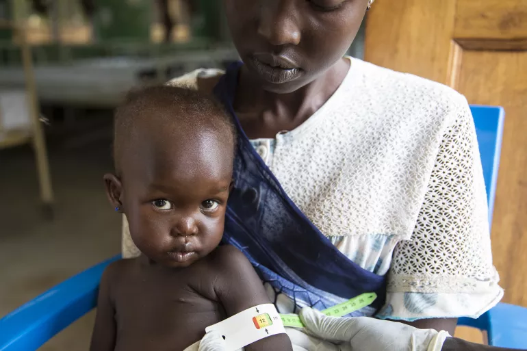 在南苏丹朱巴，小女孩Afra正在做营养不良检测。
