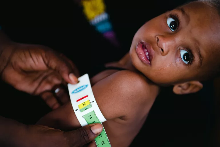 The bracelet measuring the brachial perimeter on the arm of Ousseyni (moderate malnourishment) makes it possible to assess his nutritional status at the Community health Center of Sosso-Koïra.